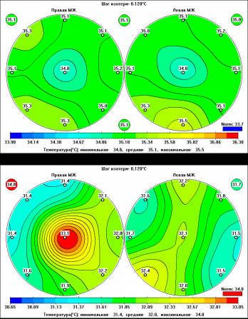 Mappe termiche di radiometria diagnostica passiva