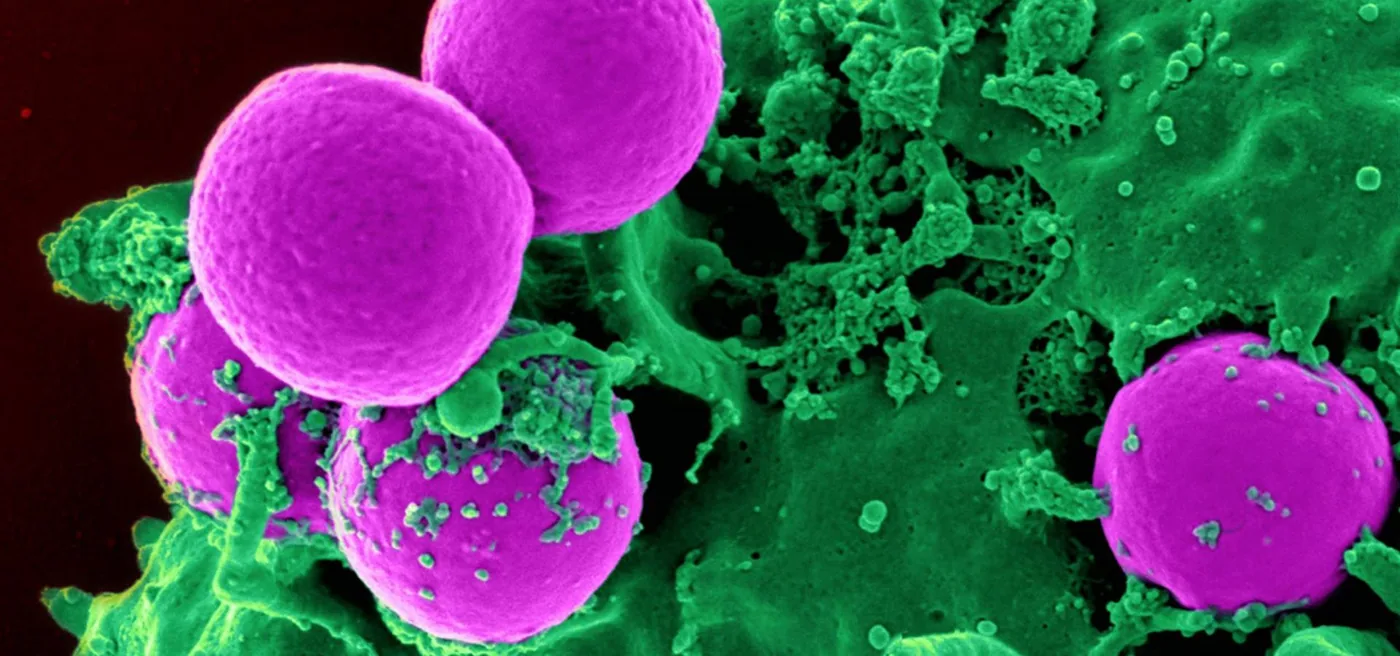 Immagine al microscopio elettronico di cellule